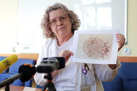 Prim. doc. dr. Tanja Planinšek Ručigaj, dr. med., predstojnica Dermatovenerološke klinike Univerzitetnega kliničnega centra Ljubljana, je opozorila na povečano število primerov garij. / Foto: Daniel Novakovič/STA